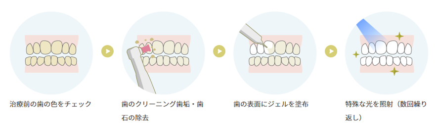 オフィスホワイトニングの流れ